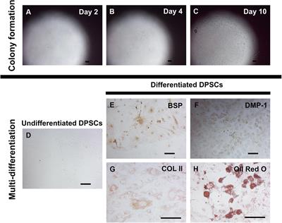 Silencing VEGFR-2 Hampers Odontoblastic Differentiation of Dental Pulp Stem Cells